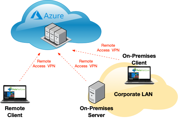 site to site remote access vpn